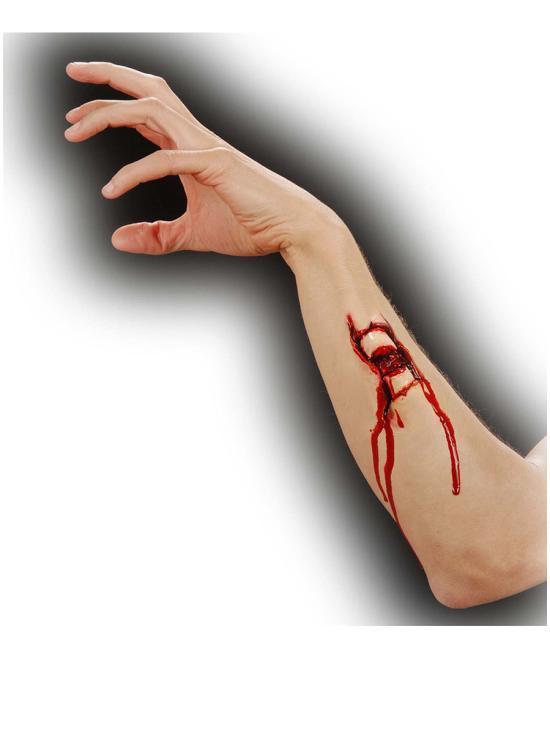 Fractura de hueso