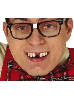 Dentes Lascados com Termoplástico